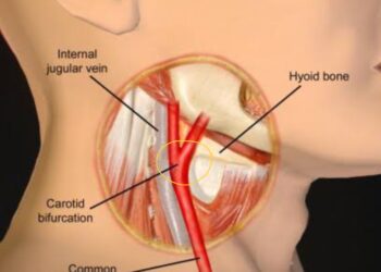 Benarkah Ciuman Cupang Bisa Picu Strok?