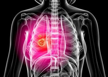 Waspada Kanker Paru Jika Batuk tak Kunjung Sembuh