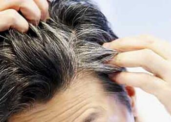 Rambut jadi Putih, 5 Faktor Ini Penyebabnya