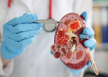 Masalah Ginjal yang Paling Tinggi Disebabkan Diabetes
