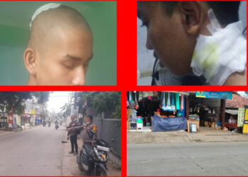 Dua Remaja Jadi Korban Begal di Gunungputri
