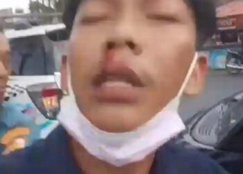 Tak Terima Disalip, Oknum TNI AL Jadi Bang Jago di Cileungsi, Sopir Pick Up di Bogem Sampe Berdarah