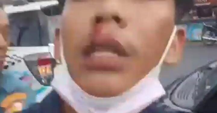 Tak Terima Disalip, Oknum TNI AL Jadi Bang Jago di Cileungsi, Sopir Pick Up di Bogem Sampe Berdarah