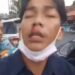 Tak Terima Disalip, Oknum TNI AL Jadi Bang Jago di Cileungsi, Sopir Pick Up di Bogem Sampe Berdarah