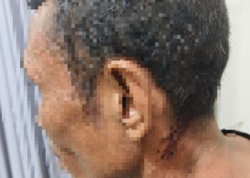 Setelah di Pinjami Motor, Daulay Justeru Pukuli Pemilik Motor