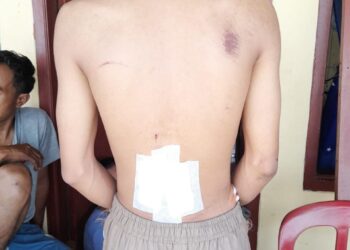 Hendak Membubarkan Tawuran, 2 Warga Kena Sabetan Cerulit