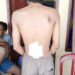 Hendak Membubarkan Tawuran, 2 Warga Kena Sabetan Cerulit