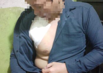 Duel Dengan Begal, Ahmad Torpilani Kena Sabetan Cerulit