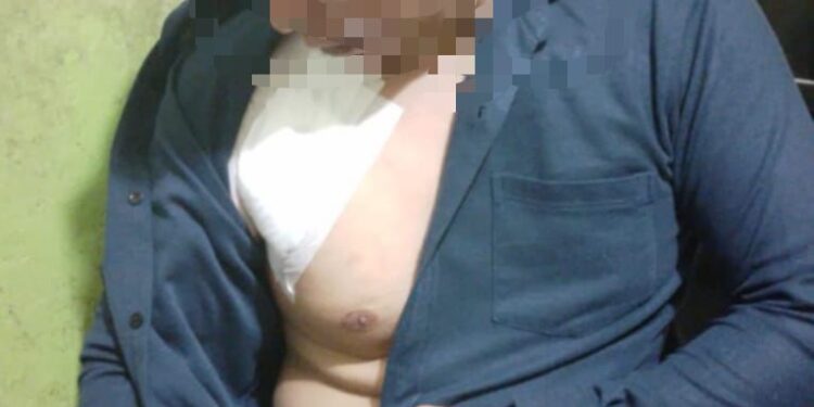 Duel Dengan Begal, Ahmad Torpilani Kena Sabetan Cerulit