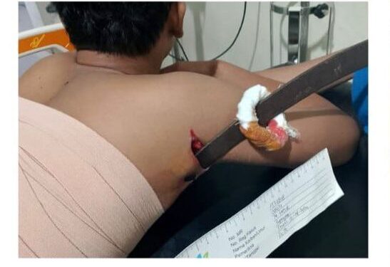 Ngeri, Akibat Tawuran Cerulit “Nancep” di Lengan