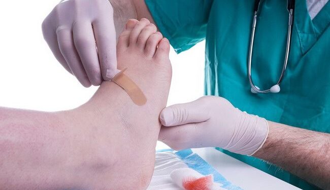 Penyakit Gula Diderita 35,8 Juta Orang Indonesia