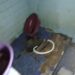 Septictank Meledak, Penghuni Rumah Alami Luka Bakar