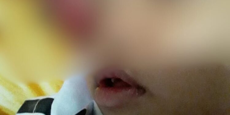 Karina Putri, Balita Asal Sukamakmur Berjuang Melawan Kanker Ganas Retina, Butuh Uluran Tangan Kita Semua