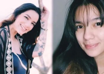 Sheila Marcia Rela Tahan Sakit Demi Hapus Seluruh Tato di Tubuh, Butuh Waktu 5 Tahun