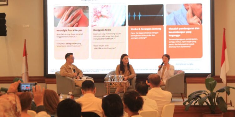 RS Siloam Jakarta Ajak Masyarakat Kenali Cacar Api lewat Healt Talk, Jakarta