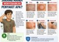 Jarang Mandi Tingkatkan Risiko Gangguan Kulit
