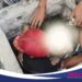 ‎Hendak Ambil Bola, Bocah 9 Tahun Terperosok ke Sumur di Ciomas Bogor